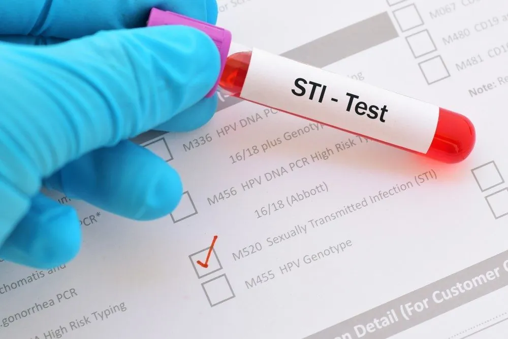 A gloved hand holding a blood sample tube labeled STI test over a lab form